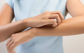 Проблеми з печінкою можуть викликати свербіж шкіри.